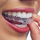 Invisalign®