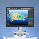 iTero 3-D Digital Impression System